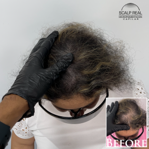 micropigmentacion capilar mujer efecto densidad en el Estado de Mexico