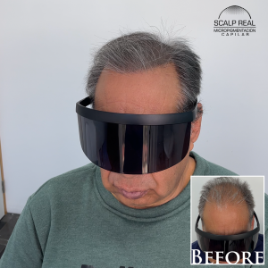micropigmentacion capilar densidad canas en ciudad de mexico