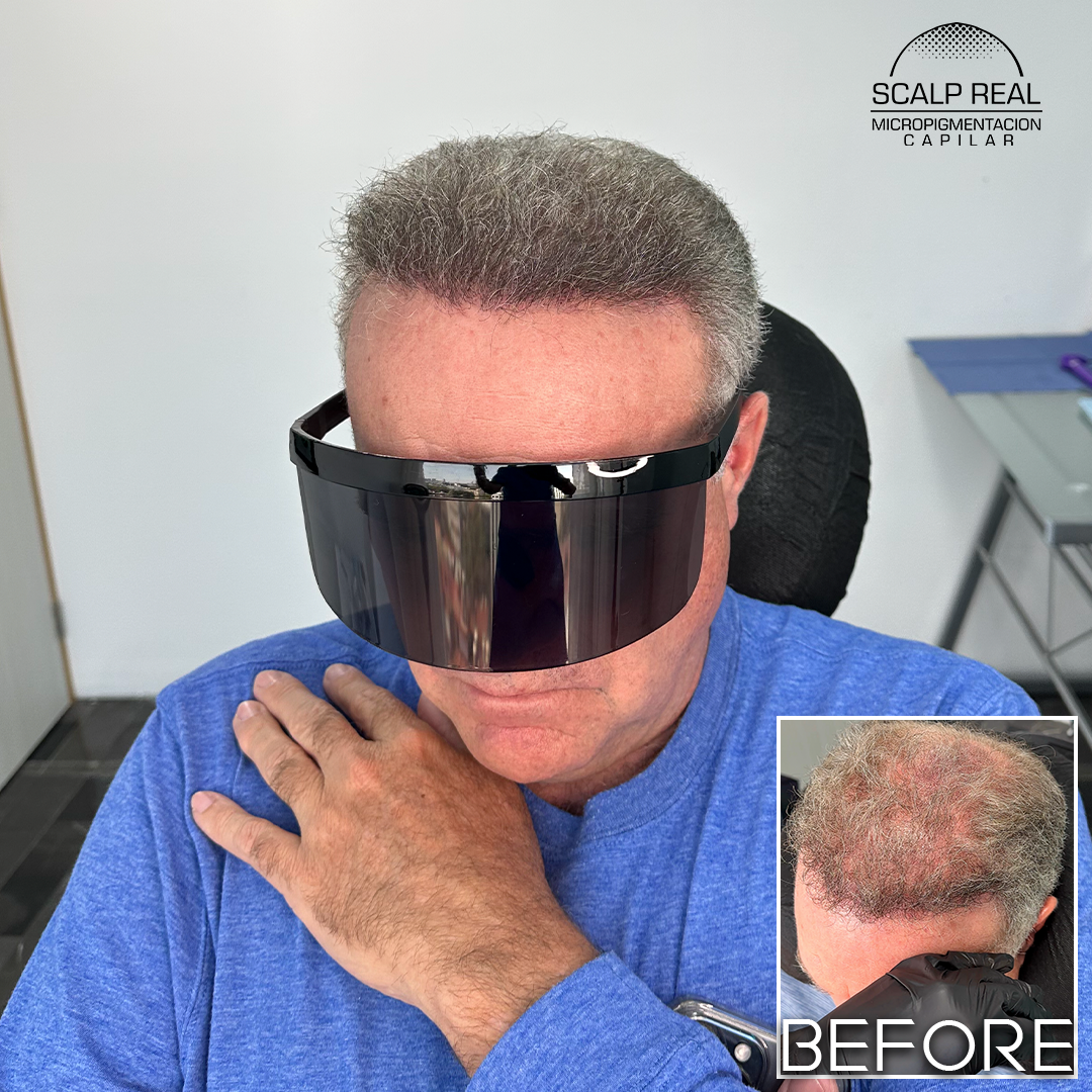 micropigmentacion capilar canas