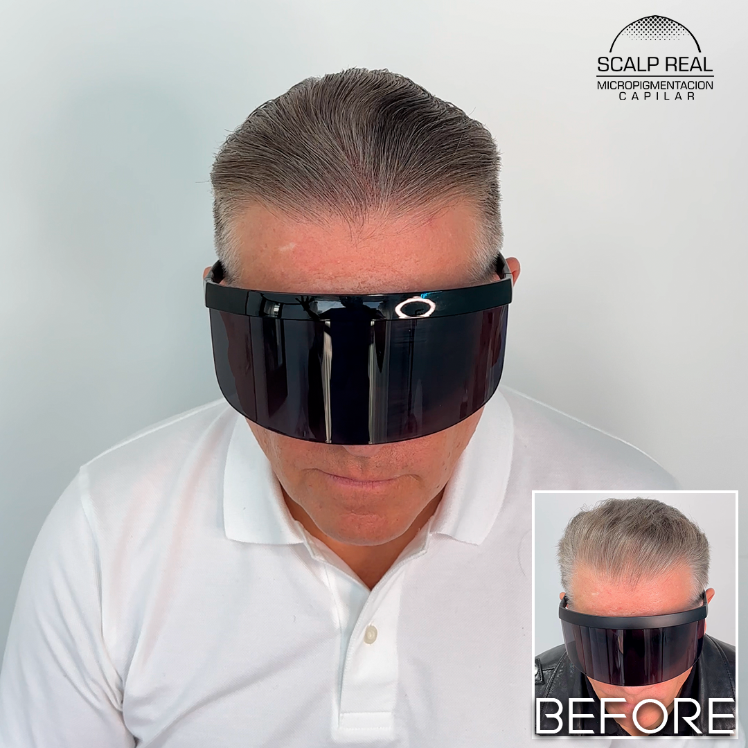 micropigmentacion capilar polanco cdmx