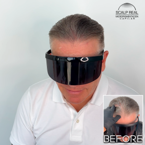 micropigmentacion capilar polanco cdmx
