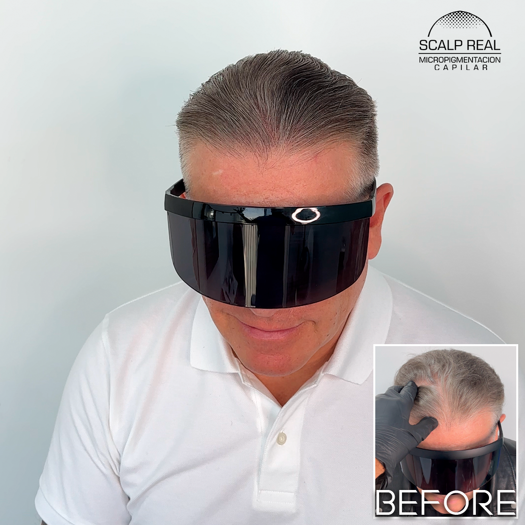 micropigmentacion capilar polanco cdmx