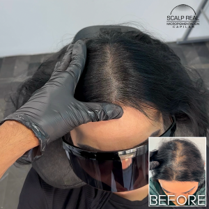 micropigmentacion capilar mujer polanco