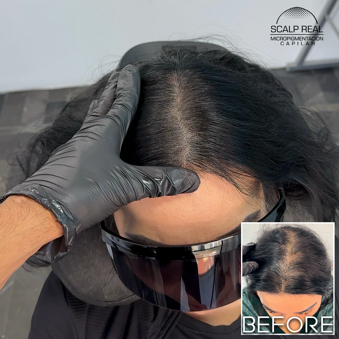 micropigmentacion capilar mujer polanco