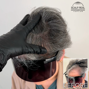 micropigmentacion capilar canas