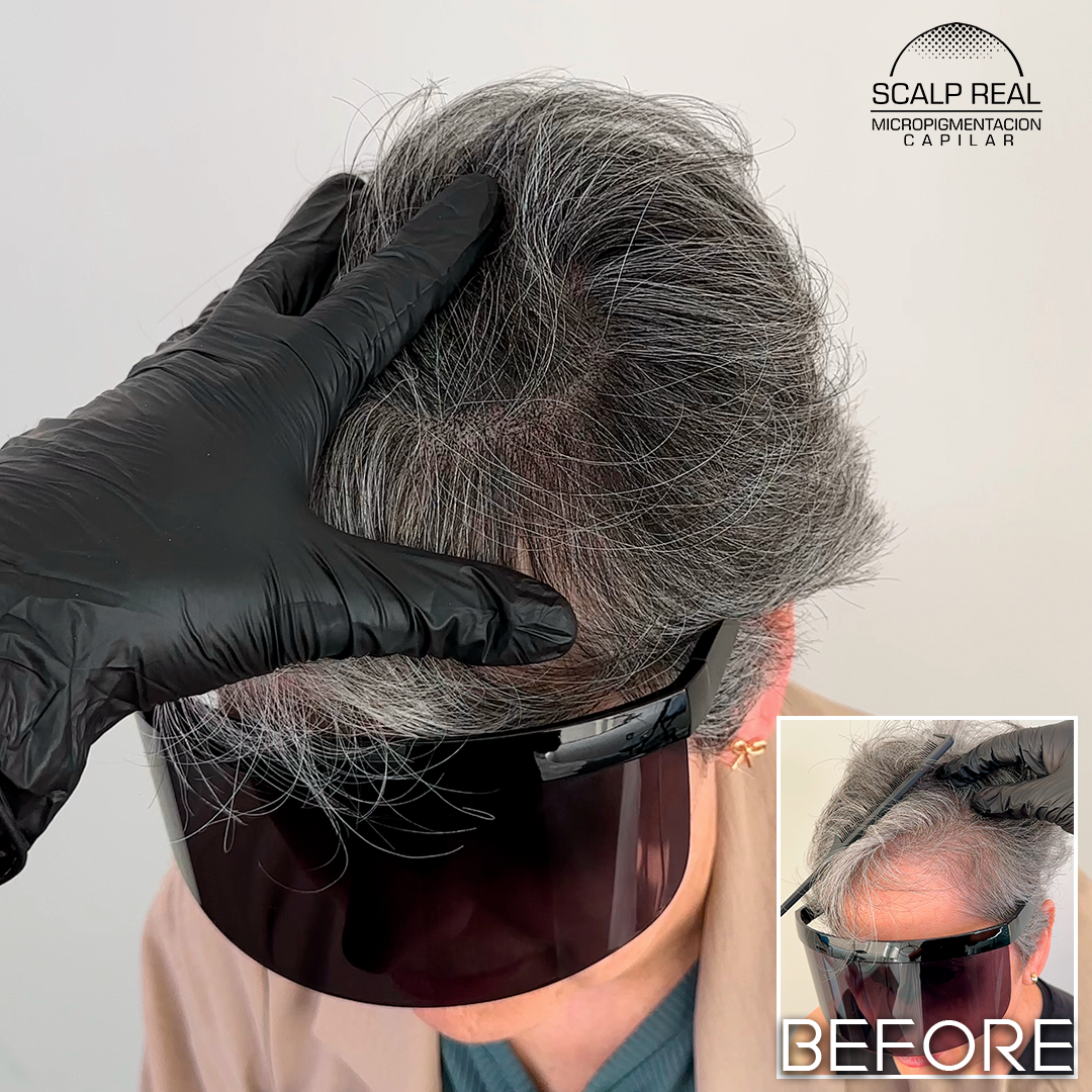 micropigmentacion capilar canas