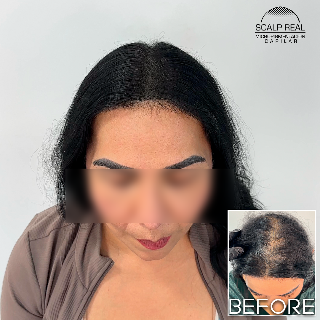 micropigmentacion capilar mujer polanco