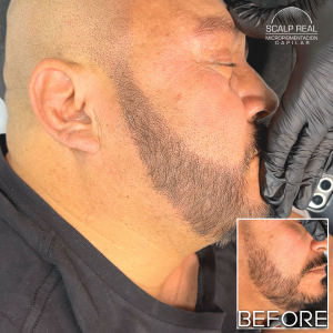 micropigmentacion de barba