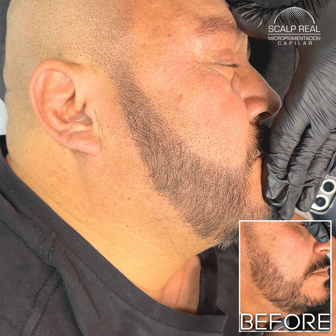 micropigmentacion de barba