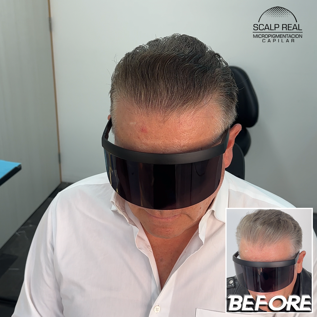 micropigmentacion capilar densidad polanco